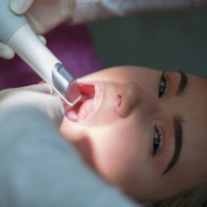 Präziser und schneller Abdruck der unsichtbaren Zahnspange dank 3D-Scanner